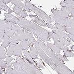 Annexin V Antibody in Immunohistochemistry (IHC)