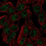 SLC5A11 Polyclonal Antibody