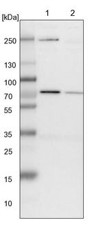 SLC25A12 Antibody in Western Blot (WB)