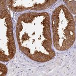 WDR92 Antibody in Immunohistochemistry (Paraffin) (IHC (P))