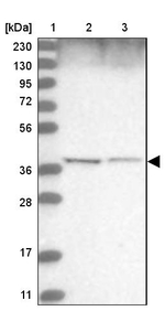 WDR92 Antibody in Western Blot (WB)