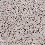 PPIL2 Antibody in Immunohistochemistry (Paraffin) (IHC (P))