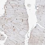 PPIL2 Antibody in Immunohistochemistry (Paraffin) (IHC (P))