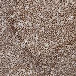 PPIL2 Antibody in Immunohistochemistry (Paraffin) (IHC (P))