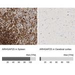 ARHGAP25 Antibody in Immunohistochemistry (IHC)