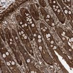ZNF511 Antibody in Immunohistochemistry (Paraffin) (IHC (P))