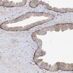 proCNP Antibody in Immunohistochemistry (IHC)