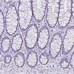 CCDC39 Antibody in Immunohistochemistry (IHC)