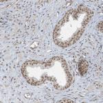 DBR1 Antibody in Immunohistochemistry (IHC)