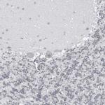 DBR1 Antibody in Immunohistochemistry (IHC)