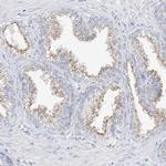 RASA2 Antibody in Immunohistochemistry (IHC)