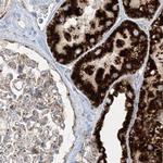NDUFAF3 Antibody in Immunohistochemistry (IHC)