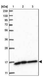 NDUFAF3 Antibody in Western Blot (WB)