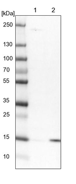 NDUFAF3 Antibody in Western Blot (WB)