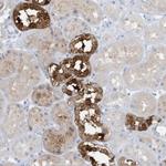 ERI2 Antibody in Immunohistochemistry (Paraffin) (IHC (P))