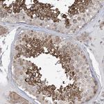 SOGA3 Polyclonal Antibody