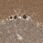 DHX36 Antibody in Immunohistochemistry (Paraffin) (IHC (P))