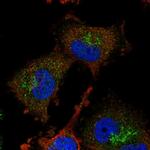 ADI1 Polyclonal Antibody