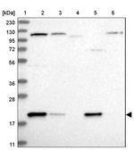 ADI1 Antibody in Western Blot (WB)