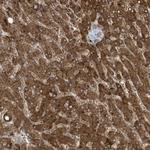 ADI1 Polyclonal Antibody