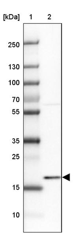 ADI1 Antibody in Western Blot (WB)