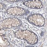 METTL8 Antibody in Immunohistochemistry (Paraffin) (IHC (P))