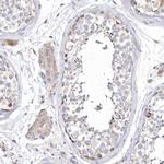 METTL8 Antibody in Immunohistochemistry (Paraffin) (IHC (P))