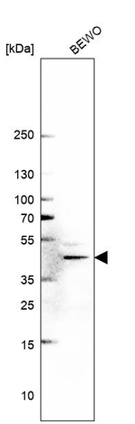 METTL8 Antibody in Western Blot (WB)
