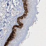 CCDC24 Antibody in Immunohistochemistry (Paraffin) (IHC (P))