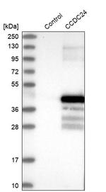CCDC24 Antibody in Western Blot (WB)