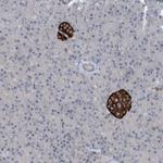 TINAG Polyclonal Antibody
