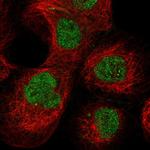 PCYT1A Antibody in Immunocytochemistry (ICC/IF)