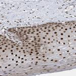 PCYT1A Antibody in Immunohistochemistry (Paraffin) (IHC (P))