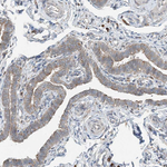 CERKL Polyclonal Antibody