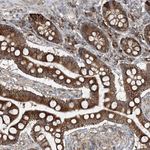 CERKL Antibody in Immunohistochemistry (Paraffin) (IHC (P))