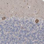 MRPS18A Antibody in Immunohistochemistry (Paraffin) (IHC (P))