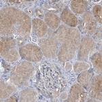MRPS18A Antibody in Immunohistochemistry (Paraffin) (IHC (P))
