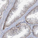 MRPS18A Antibody in Immunohistochemistry (Paraffin) (IHC (P))