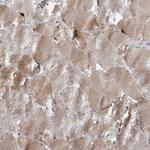 MRPS18A Antibody in Immunohistochemistry (Paraffin) (IHC (P))