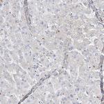 ANKRD35 Antibody in Immunohistochemistry (Paraffin) (IHC (P))