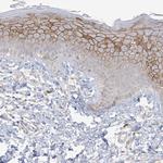 ANKRD35 Antibody in Immunohistochemistry (IHC)