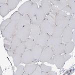 ANKRD35 Antibody in Immunohistochemistry (IHC)