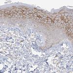 ANKRD35 Antibody in Immunohistochemistry (IHC)