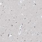 RFX7 Antibody in Immunohistochemistry (Paraffin) (IHC (P))