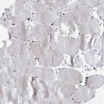 RFX7 Antibody in Immunohistochemistry (Paraffin) (IHC (P))