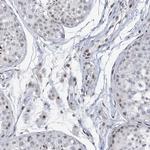 RFX7 Antibody in Immunohistochemistry (Paraffin) (IHC (P))
