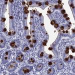 TFF3 Antibody in Immunohistochemistry (IHC)