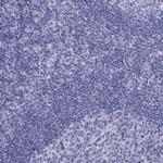 TFF3 Antibody in Immunohistochemistry (IHC)