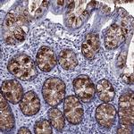 TFF3 Antibody in Immunohistochemistry (IHC)