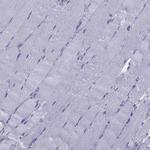 TFF3 Antibody in Immunohistochemistry (IHC)